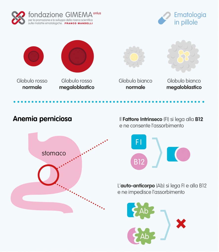 Anemia vitamina B12 e Folati – Ematologia in Pillole – Fondazione GIMEMA