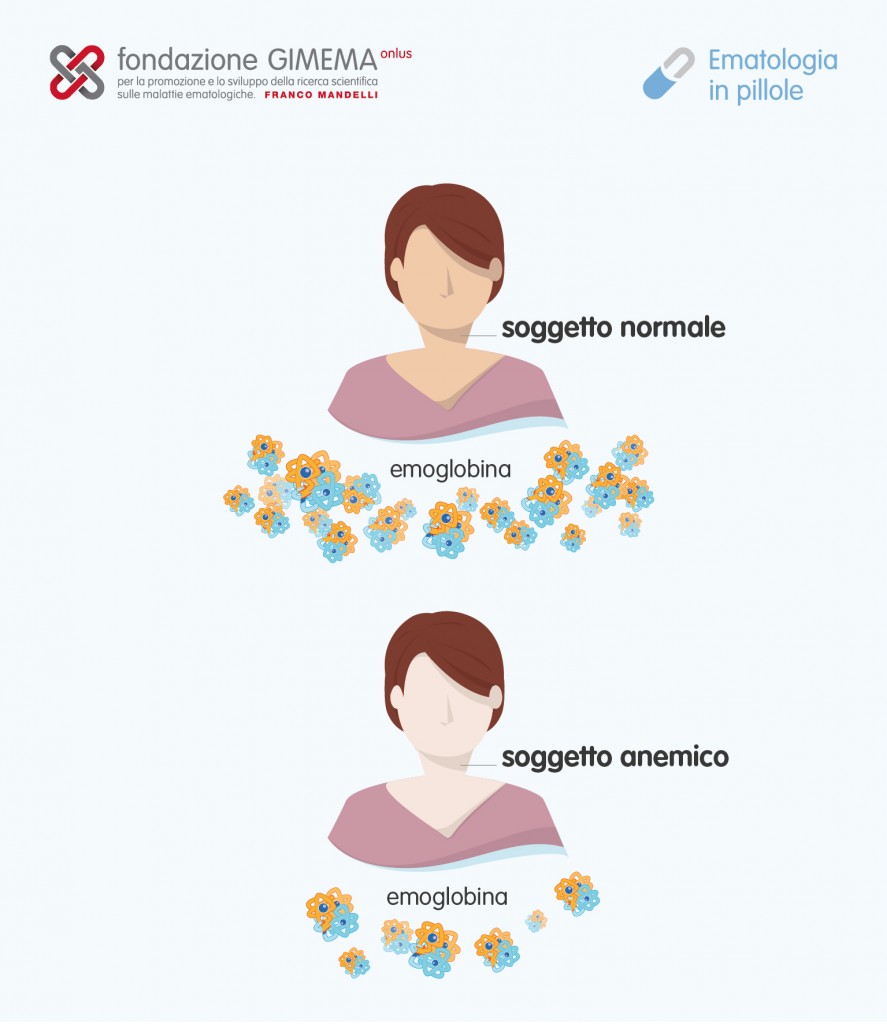Le anemie – Ematologia in pillole – Fondazione GIMEMA
