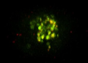 Cellula leucemica contentente i vettori con Il farmaco (fluorescenti)