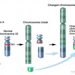 cml_ traslocazione cromosoma