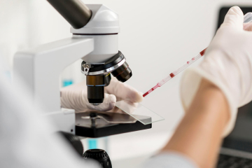 terapie mirate nella leucemia mieloide acuta – Fondazione GIMEMA