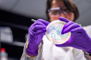 Microbiota intestinale nel trapianto allogenico di cellule staminali emopoietiche – Fondazione GIMEMA