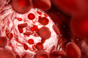 anemia falciforme terapia genica