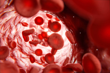anemia falciforme terapia genica