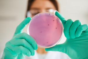 infezioni leucemia linfoblastica acuta