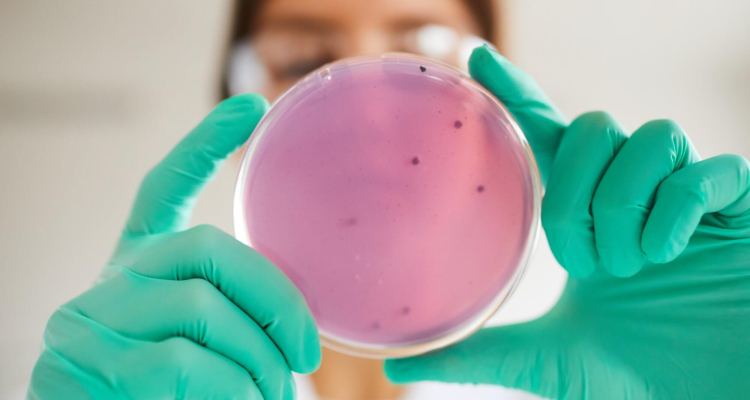 infezioni leucemia linfoblastica acuta