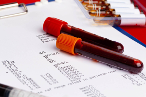 leucemia promielocitica acuta diagnosi