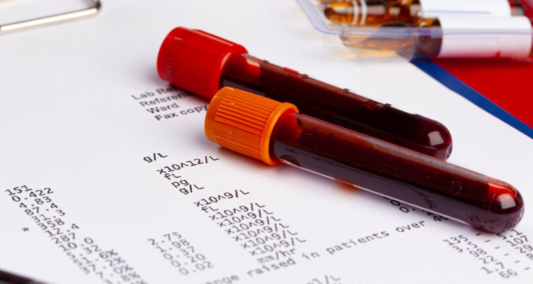 leucemia promielocitica acuta diagnosi